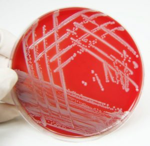 MRSA staph infections could be effectively treated with antimicrobials