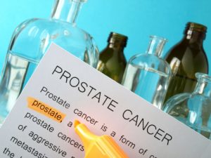 Prostate cancer treatment linked with Alzheimer’s disease risk