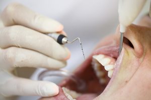 Tooth loss, complication of diabetes