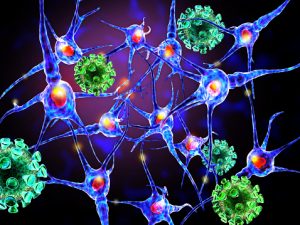 Steps closer to possible cause of multiple sclerosis (MS)