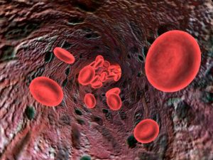 Anemia can lead to false type 2 diabetes diagnosis, research shows