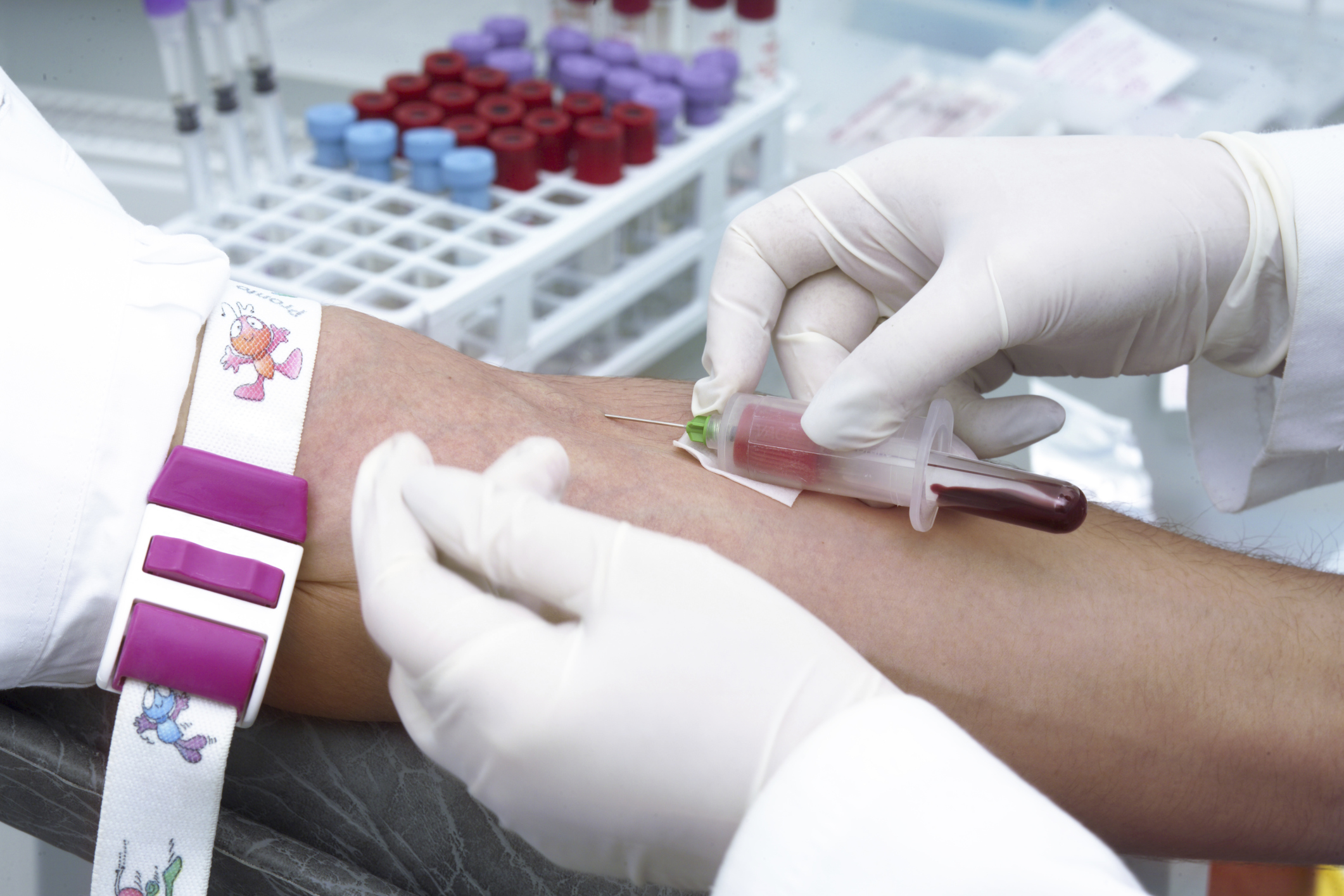 Blood test may predict when anti...
