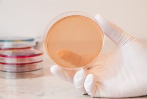 Shigella infections spreading in the U.S., becoming resistant to recommended antibiotics
