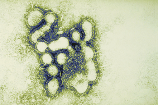 Minor flu strains can cause majo...