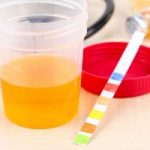 Urinary tract infections inuenced by diet and acidity of urine