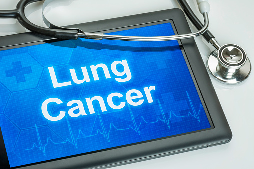 Protect against lung cancer duri...