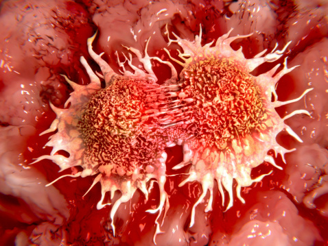 Twins study shows cancer could r...