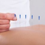 Acupuncture and breast cancer treatment