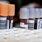 Cancer treatment could improve with simple blood test