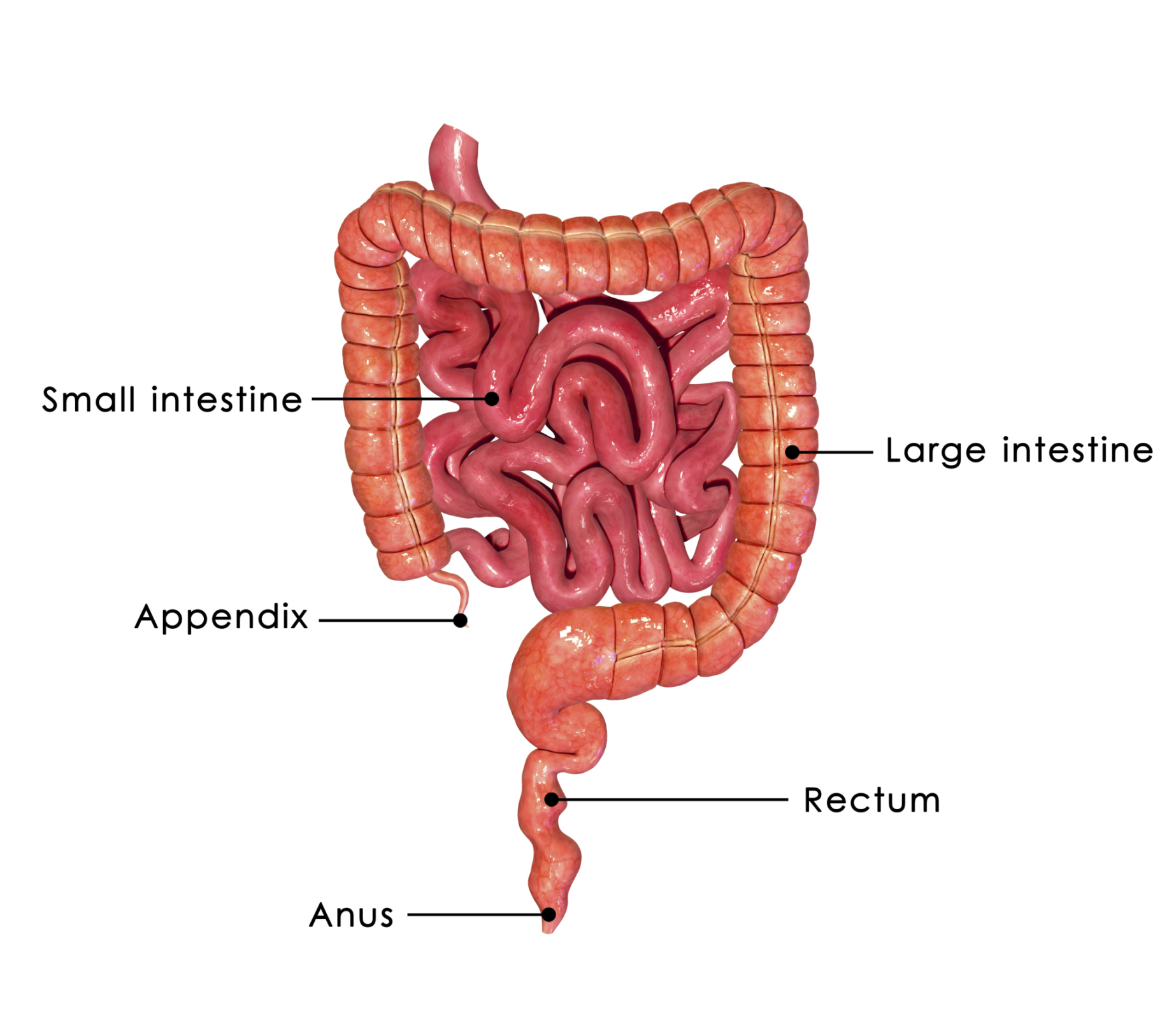 IBD, ulcerative colitis, and Cro...