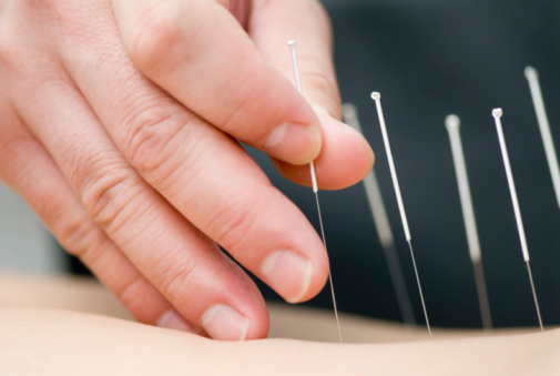 Acupuncture treatment may help w...