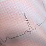 Cardiac sarcoidosis raises arrhythmia and heart failure risk