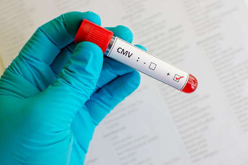 Cytomegalovirus (CMV) infection ...