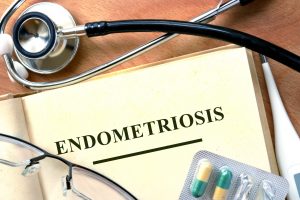 endometriosis pelvic pain women