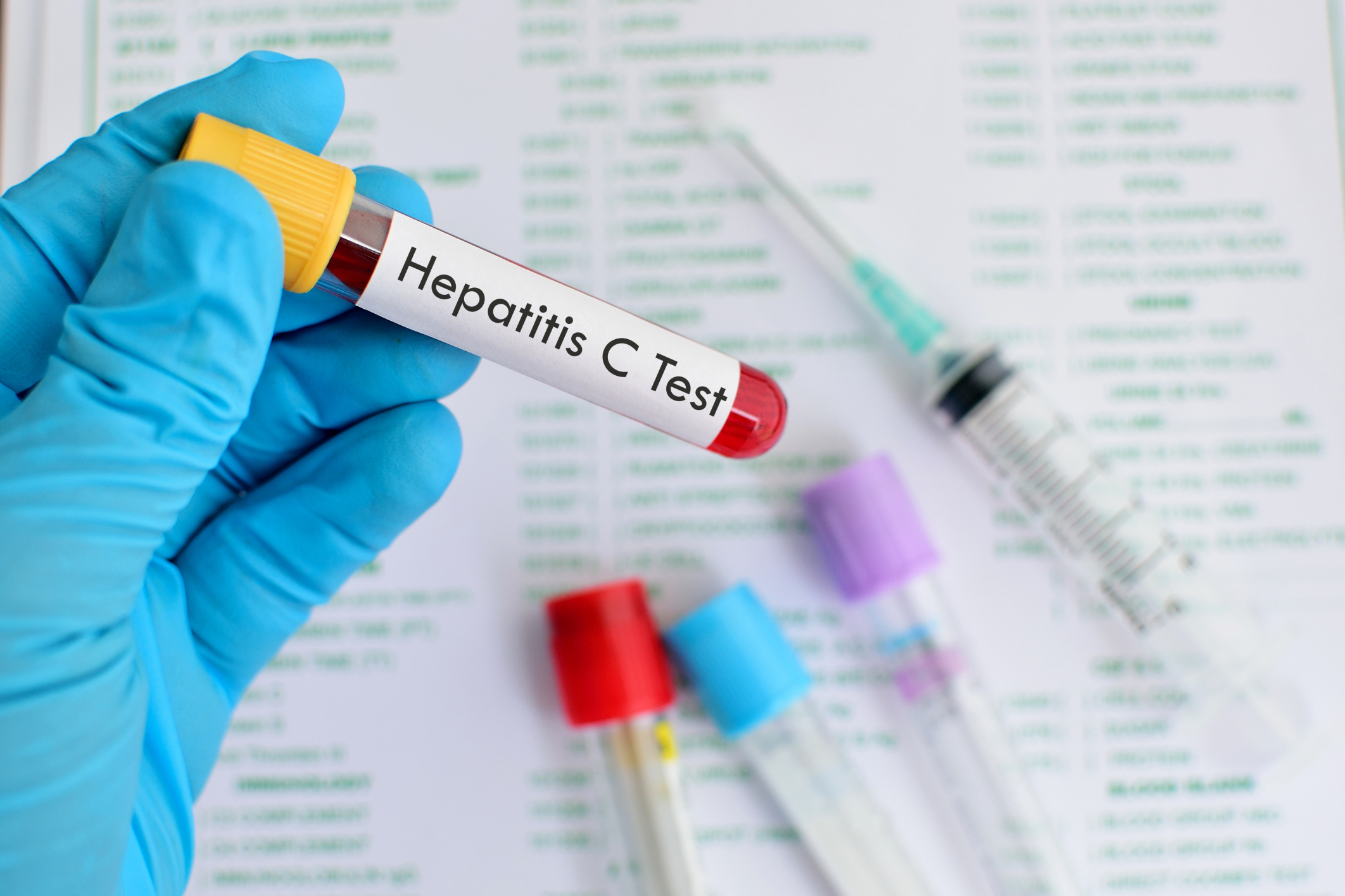 Hepatitis C infection increases ...