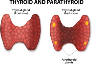 Osteoporosis risk increases in hyperparathyroidism patients due to excess parathyroid hormone (PTH)