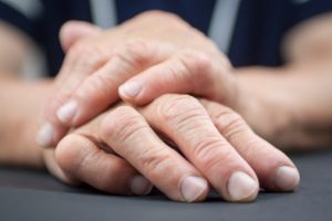 Rheumatoid arthritis in women