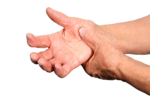Rheumatoid arthritis risk increa...