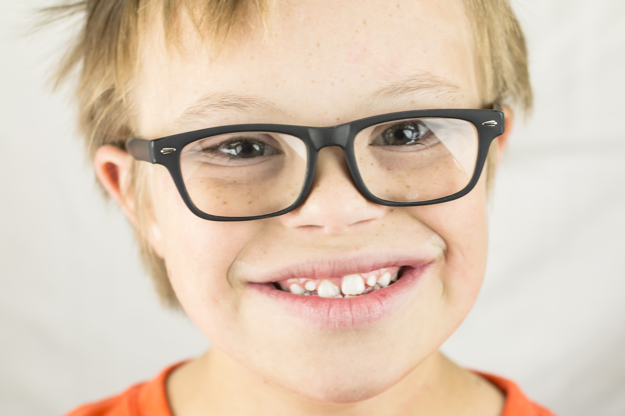 For vision disorders in Down syn...