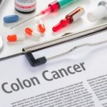 colon cancer patients