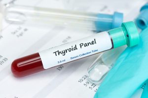 Hypothyroidism (underactive thyroid gland) treatment guidelines 
