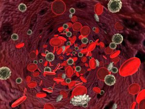 Lupus patients face anemia risk from inflammation, iron deficiency, and renal insufficiency
