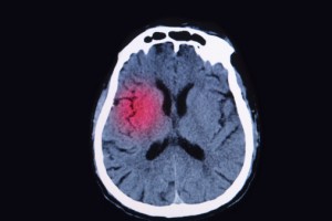 Brain Injury Awareness Month 201...