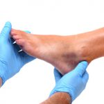 Diabetes, gangrene and diabetic foot amputation risks