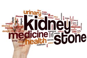 kidney-stone-and-type-2-diabetes