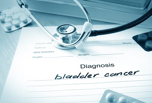 Diabetes medication causes bladder cancer