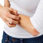 Fibromyalgia skin disorders itching rash