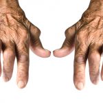 Rheumatoid arthritis risk in women with ptsd higher
