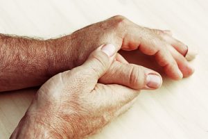 Rheumatoid arthritis risk influenced by low testosterone levels in men