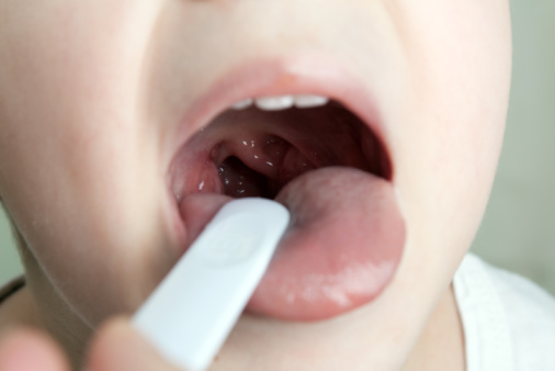 Swollen uvula causes and symptom...