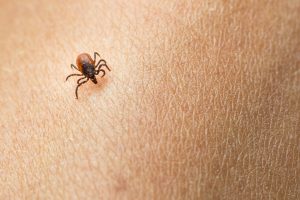 tips to prevent Lyme disease, tick bites