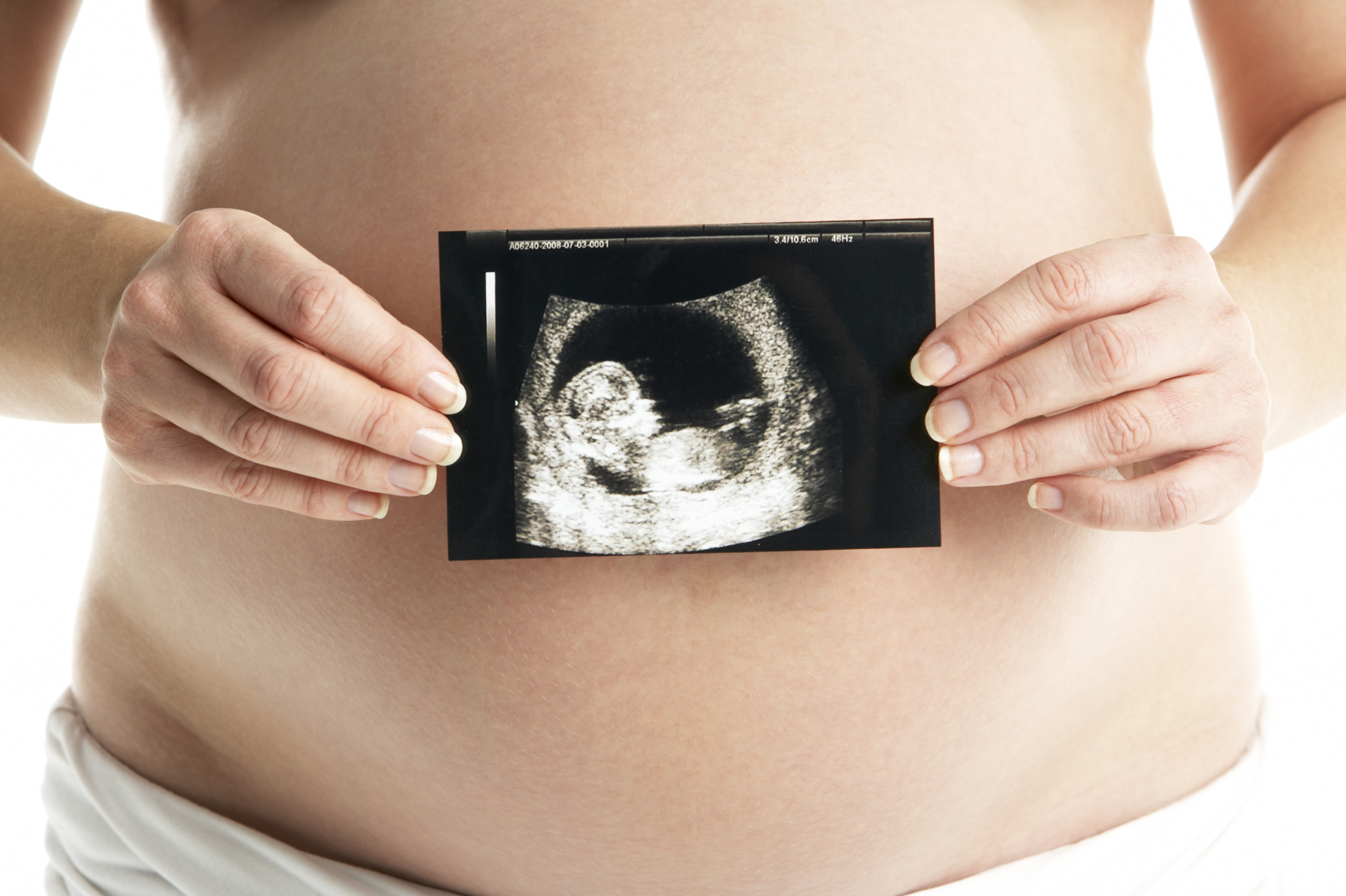 Body fat in babies associated wi...