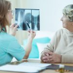 Celiac disease increases osteoporosis and bone fracture risk