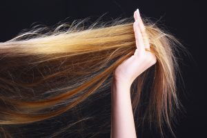 What your hair (and scalp) say about your health