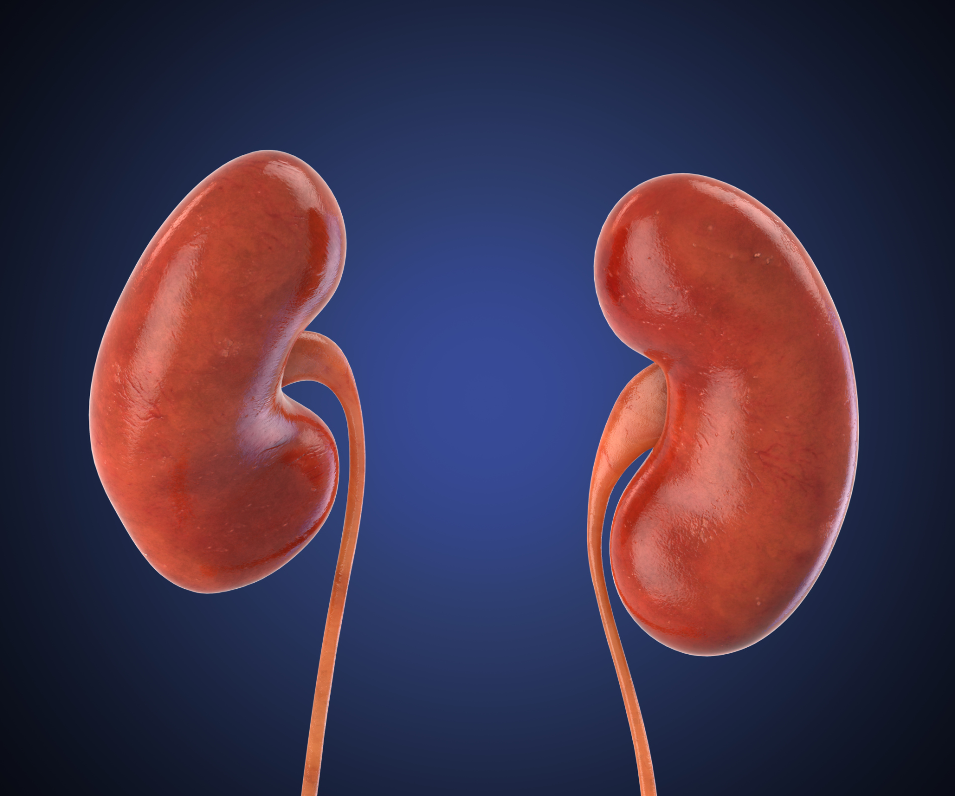 Kidney stones rise significantly...