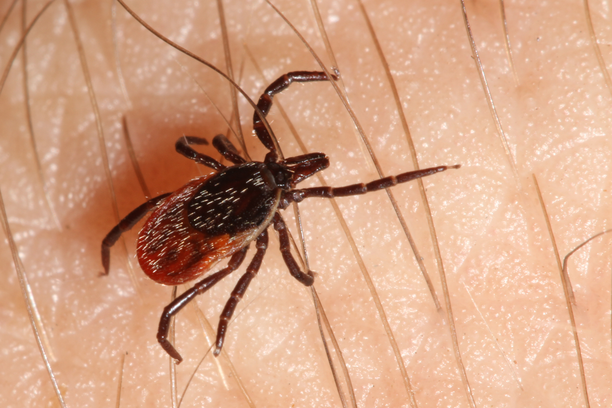Lyme disease can prevent the imm...