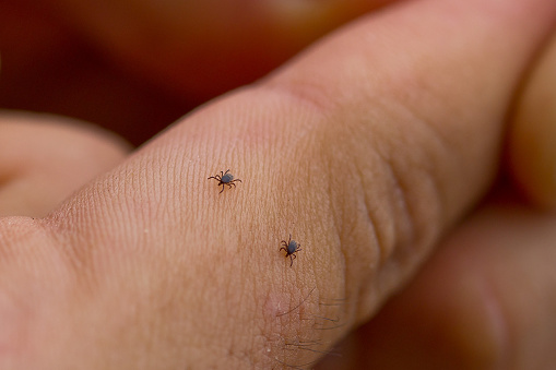 Lyme disease transmitted by tick...