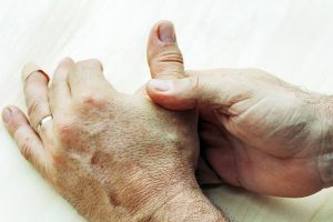 Rheumatoid arthritis vs. osteoarthritis