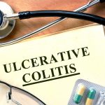 Ulcerative colitis flare up