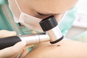 Untreated sleep apnea linked to aggressive melanoma