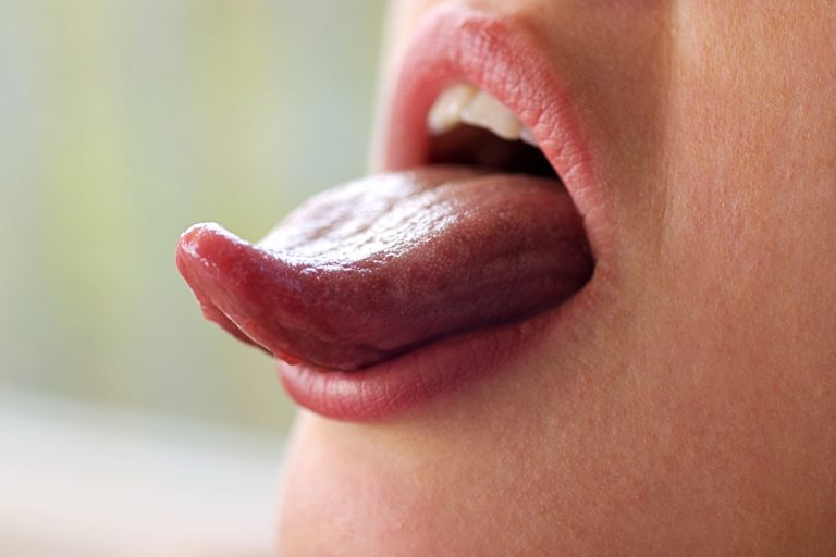 10 Common Causes and Treatments for Yellow Tongue