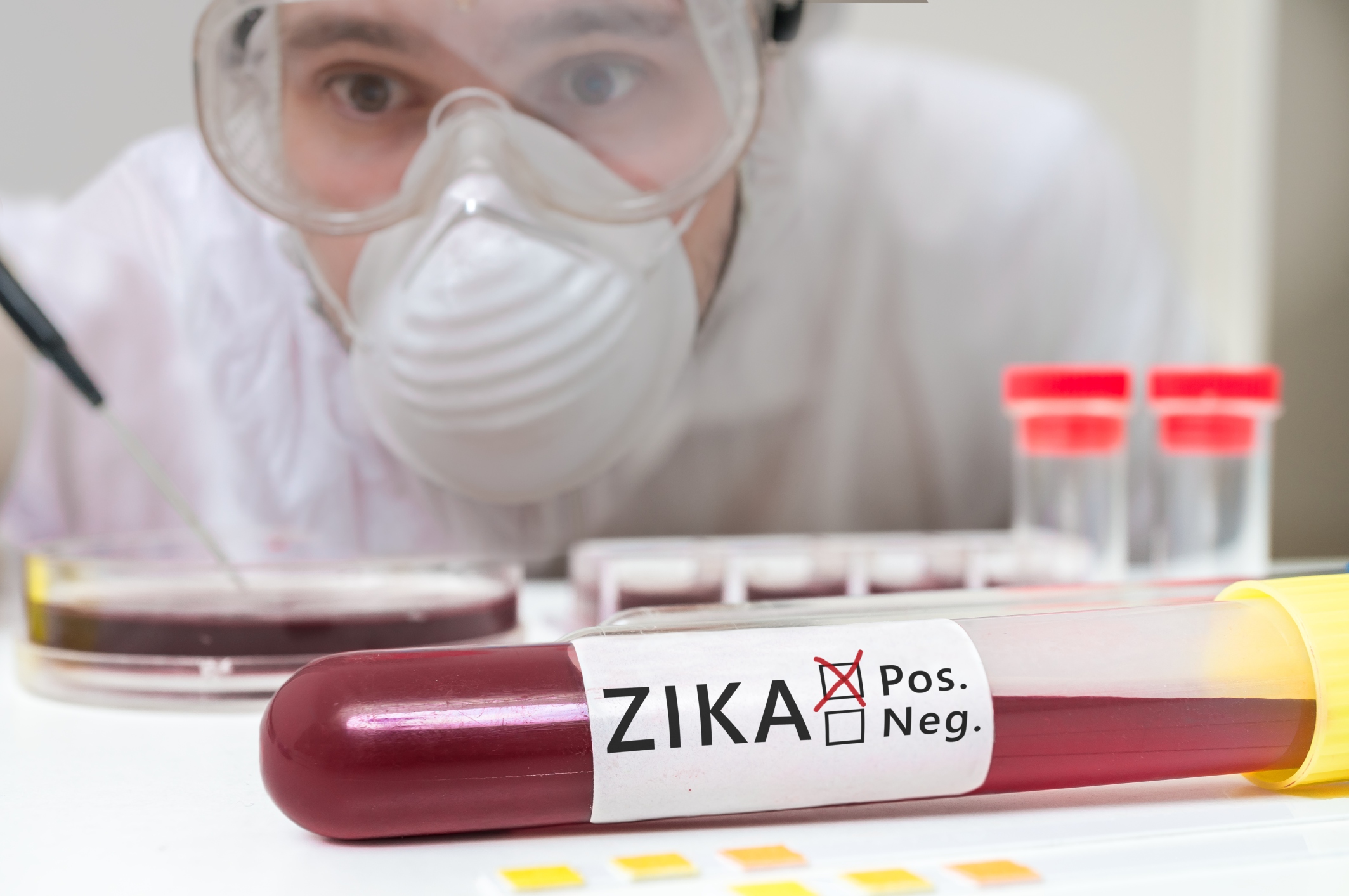 Zika virus development slowed by...