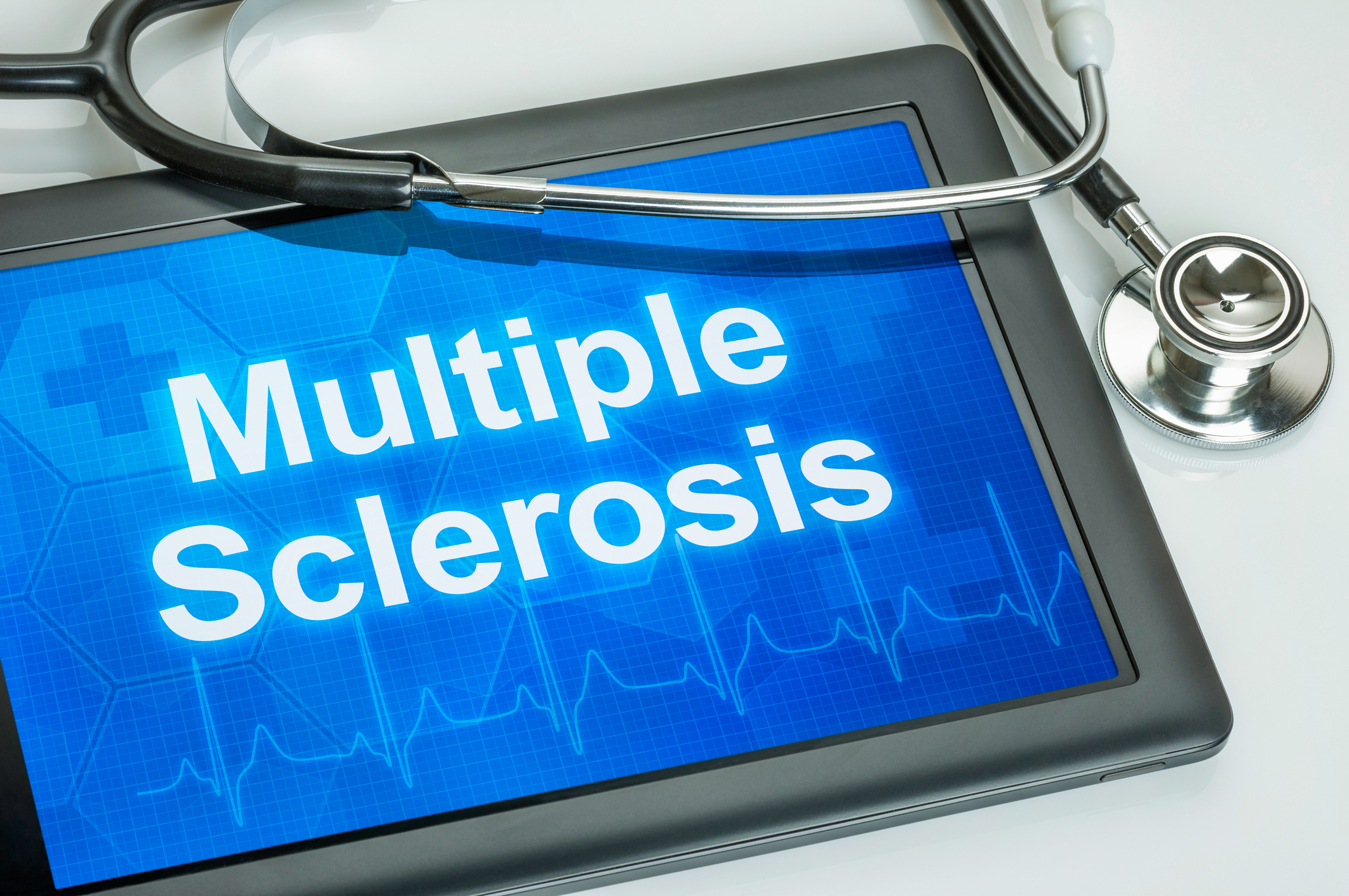 Multiple sclerosis vs. NMO, diff...