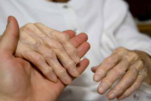 Psoriatic arthritis vs. osteoart...