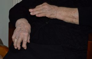 rheumatoid arthritis biologics treatment reduce cardiovascular risk