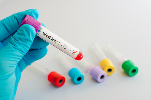 West Nile virus 2016: Researcher...